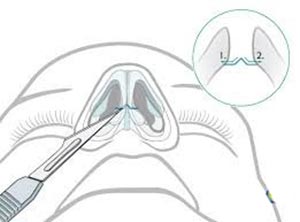جراحی-ترمیمی-2